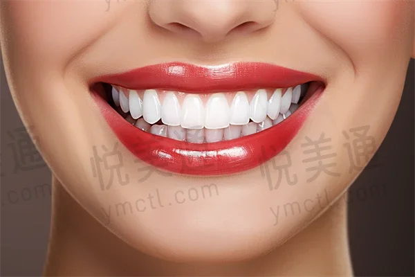 北京瑞冠口腔门诊部(冠庭中心店)洗牙优惠：原价299元起，现仅需199元起，助您拥有健康口腔！