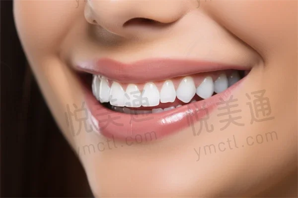 杭州成全口腔余杭门诊部烤瓷牙现仅需2500元起，助您轻松实现美丽笑容！原价3000元起，优惠力度不容错过！