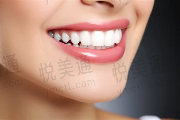 优惠活动！益阳德美口腔门诊部补牙仅需350元起，原价500元起。