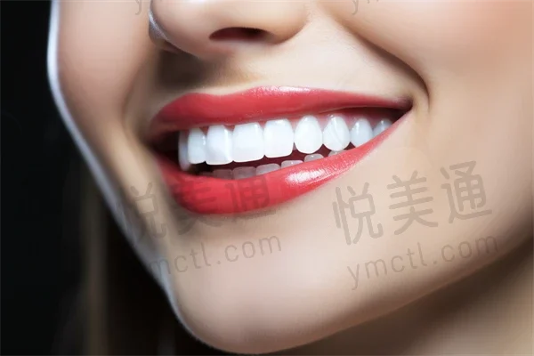 三亚欧迪口腔门诊部口腔修复费用现仅需2500元起，原价3000元起，限时优惠活动！