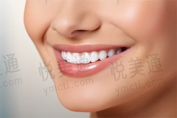 荣成卓雅口腔门诊部牙齿美白费用现仅需699元起，原价899元起，限时优惠！