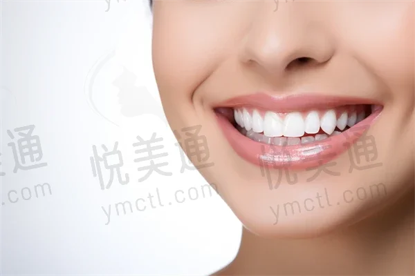 武汉咿呀口腔门诊（光谷店）洗牙优惠价目表：原价298元起，现仅需198元起，期待您的光临体验！