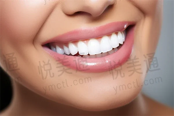 优惠价仅需666元起，上海贝德口腔口腔预防保健服务原价888元起，限时优惠，快来体验！