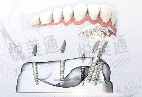 客户实例分享