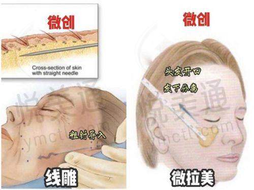 深圳美南华黄崇熙整形医院靠谱吗？看基本信息、特色项目、价格及患者评价给你答案