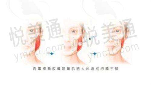 北京美莱植发医院靠谱吗？从技术、医生、设备到收费全面分析，给脱发患者实用参考