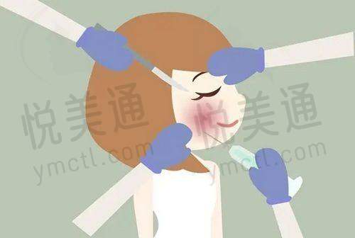 东莞东城非凡美容医院靠谱吗？营业多年，颜江、张娟莲医生技术好，隆鼻等项目受称赞