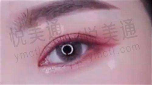 合肥东方怡人医疗美容门诊部咋样？2018年成立，科室全项目多，口碑服务都不错