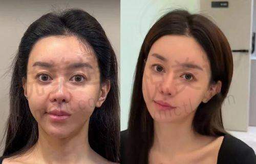 平顶山艺美医疗美容医院做双眼皮靠谱吗？完成众多案例，暑期特惠搭配先进设施别错过