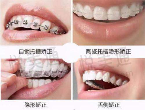 价格收费情况