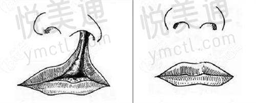 淄博丽美整形医院紧缩针项目优势