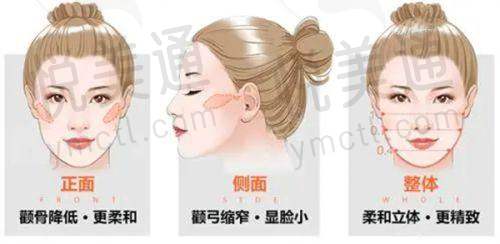 威海佳医整形的服务与口碑